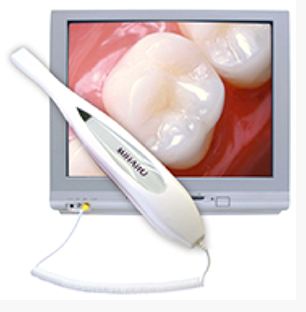 Intra-oral camera device used by Dr. William Samson